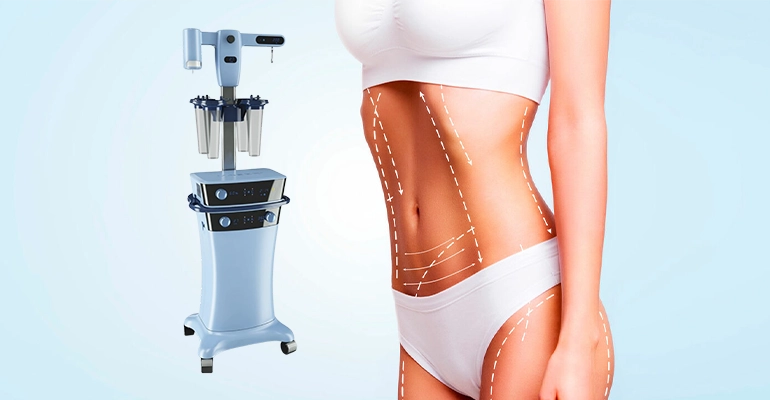 Liposuccion VASER en Tunisie