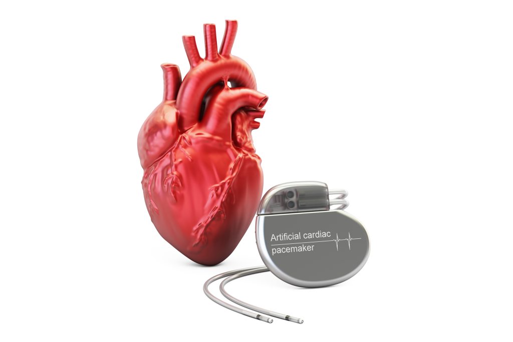 pacemaker en Tunisie