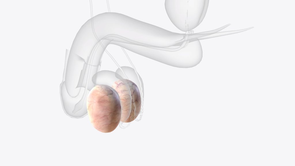 implants de testicule en Tiunisie
