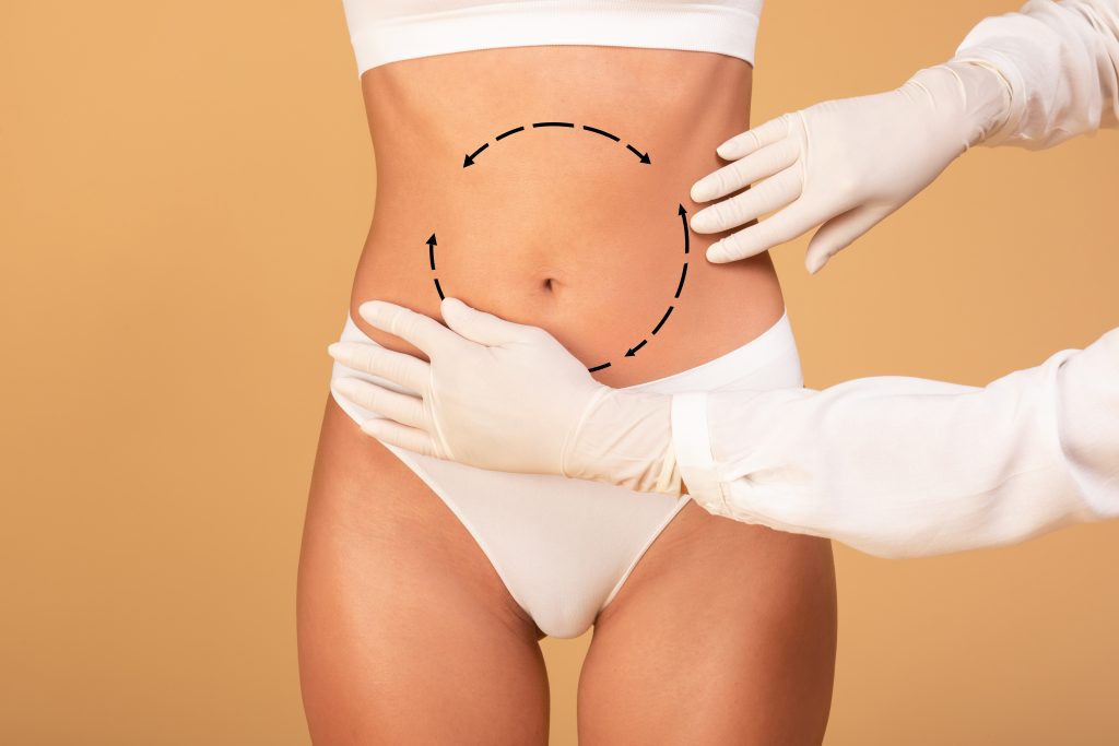 Liposuccion J-Plasma en Tunisie