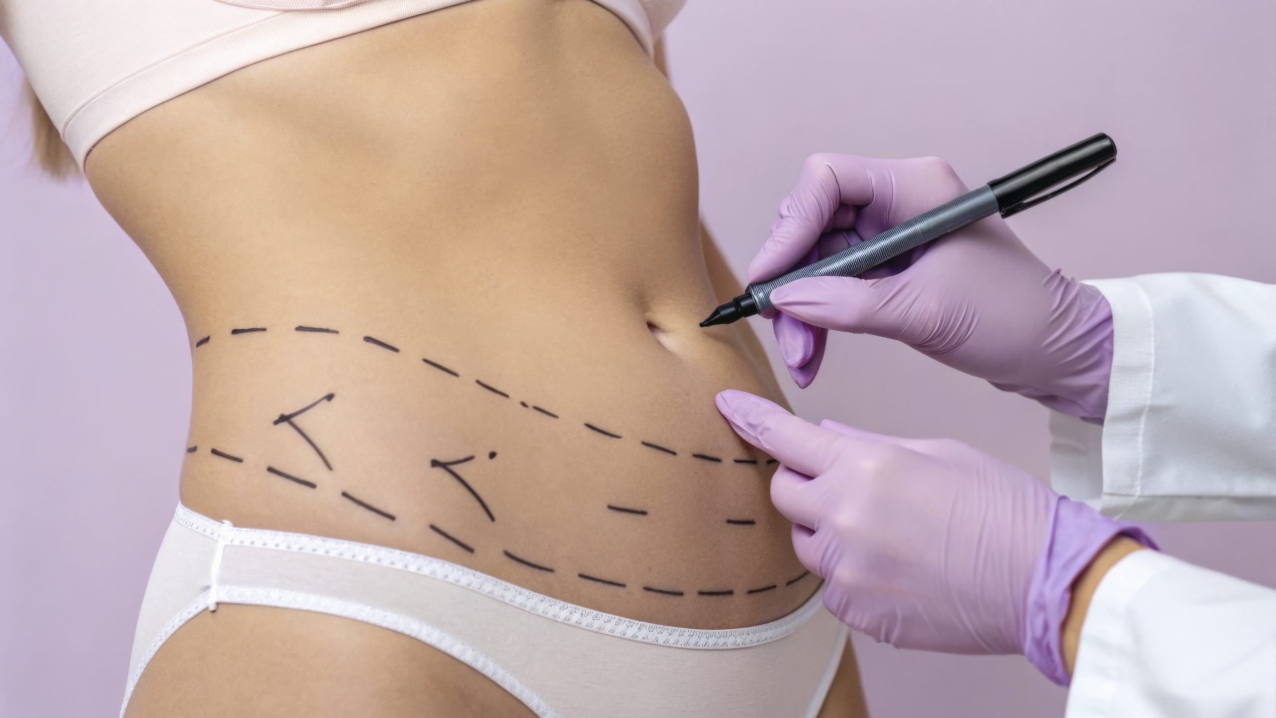 Abdominoplastie Prix en Tunisie