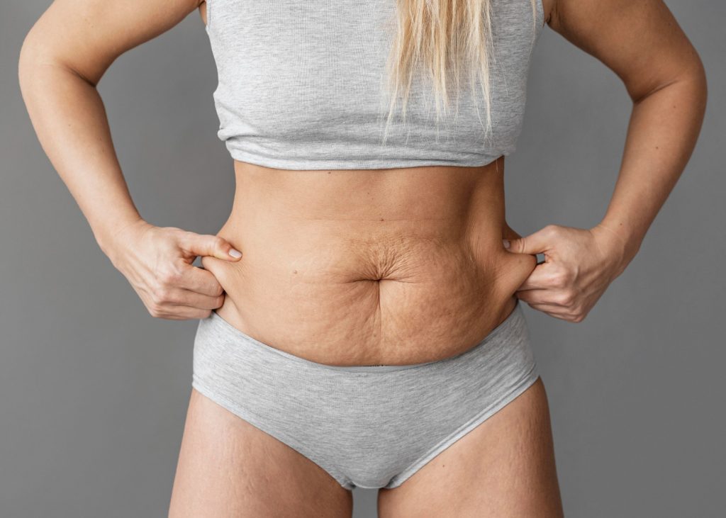 Abdominoplastie en Tunisie