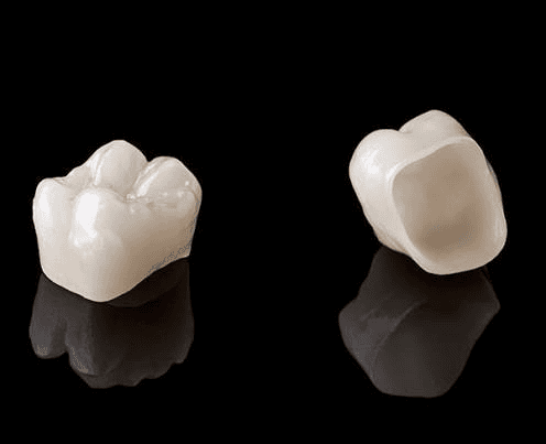 Implants dentaires en Tunisie