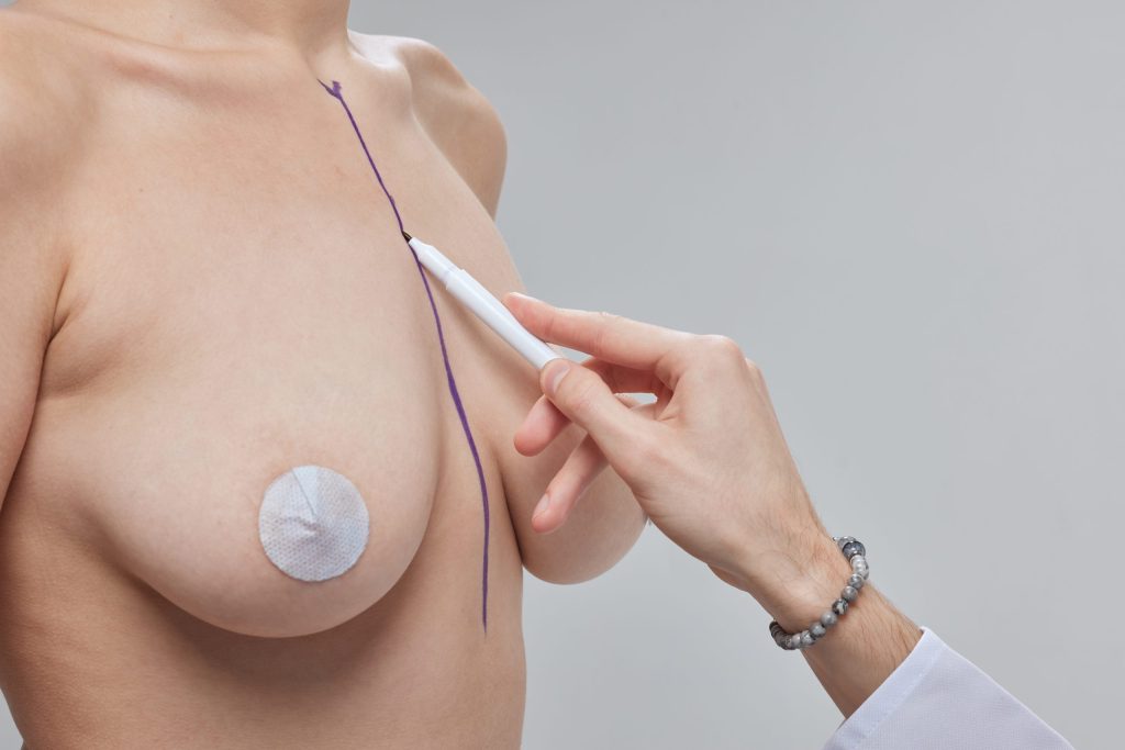 corriger des seins qui tombent en Tunisie